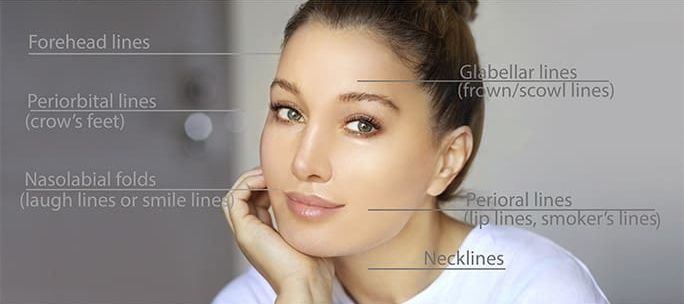 Botox Treatment Areas