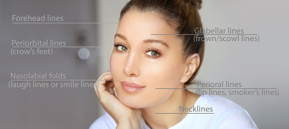 Female with Botox treatment areas indicated